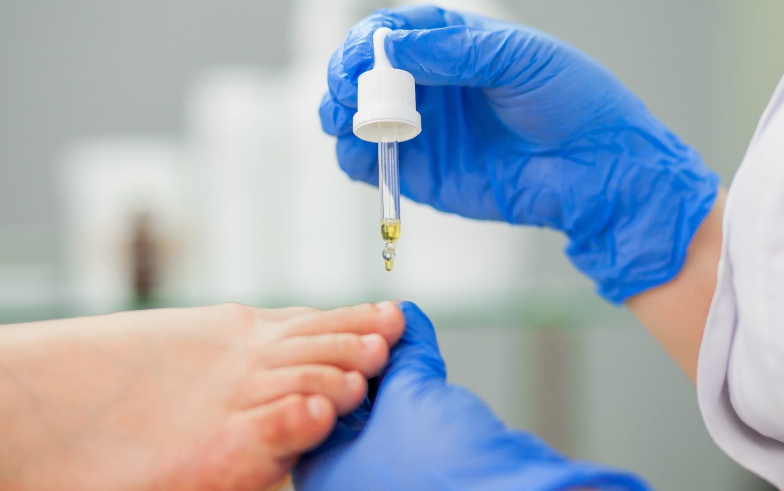 ata acido tricloroacetico aplicado a podologia