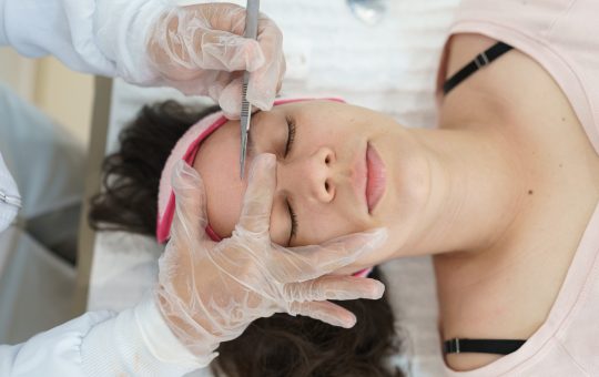 dermaplaning