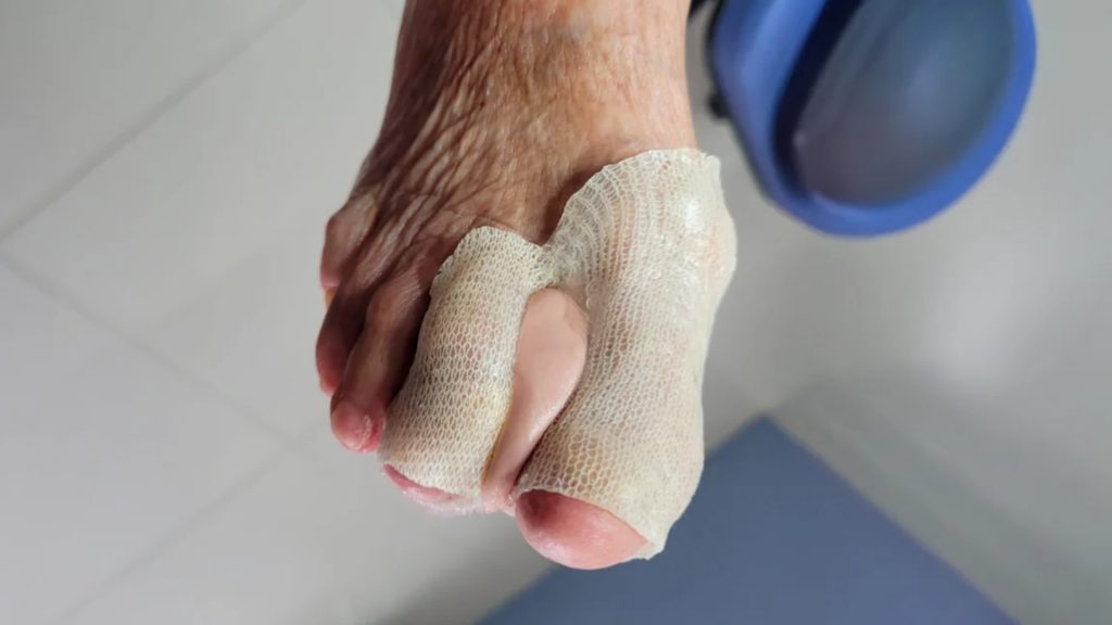ortoplastia