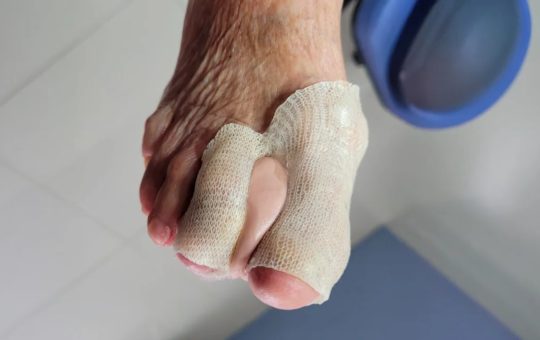 ortoplastia
